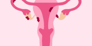 Women’s Reproductive Health