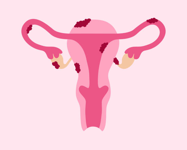 Women’s Reproductive Health